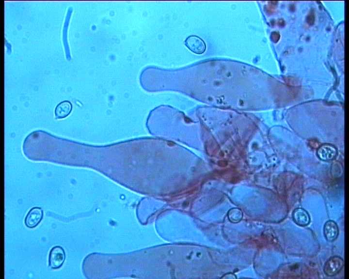 Volvariella hypopithys